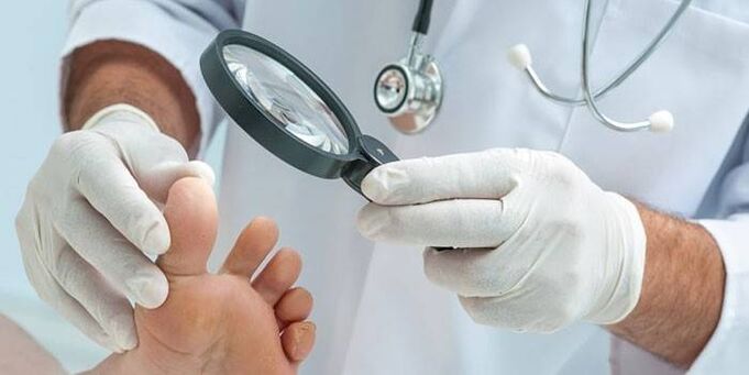 El médico examina el pie de un paciente con una espiga con una lupa